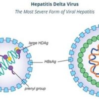 三亿慢性乙肝患者—-您缺少筛查Hepatitis D